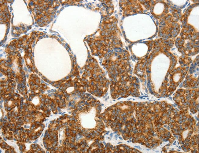SLC12A4 / KCC1 Antibody
