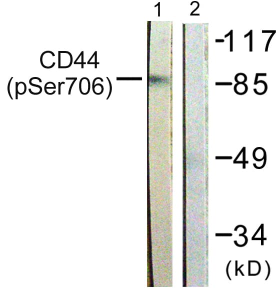 Polyclonal Rabbit anti-Human CD44 Antibody (phospho-Ser706, WB)