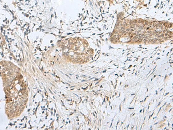 SNRPD1 / SMD1 Antibody