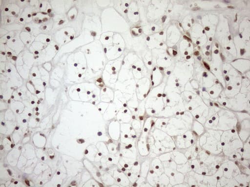 MGMT Antibody (clone OTI2E2)