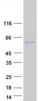 Human ADAMTSL5 Protein (Recombinant Myc-DDK (Flag))