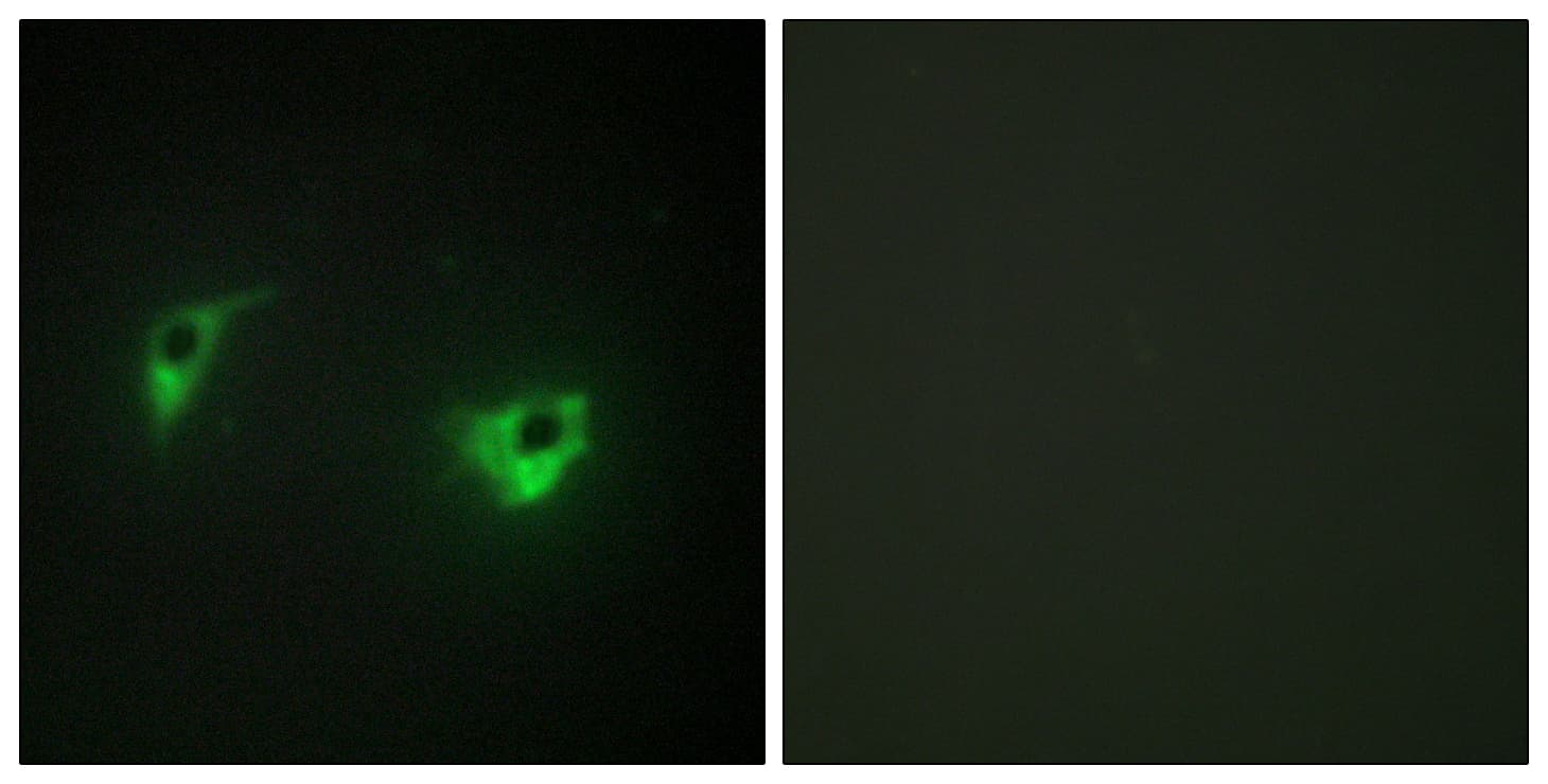 MAP4K4 Antibody (aa406-455)