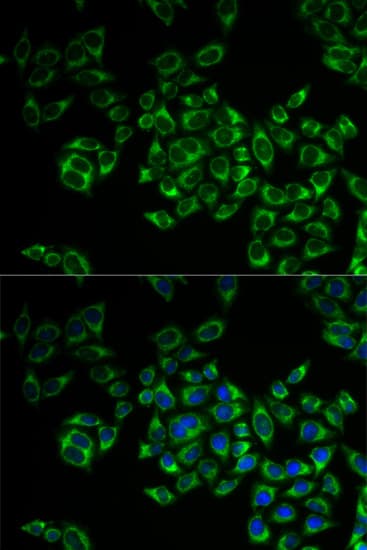 FIS1 Antibody