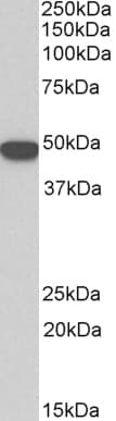 PathPlus™ KRT18 / CK18 / Cytokeratin 18 Antibody (aa200-300)