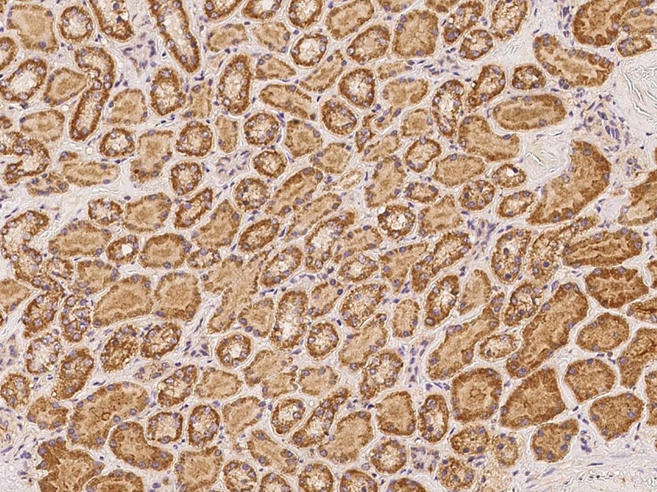 Polyclonal Rabbit anti-Human TTC39A Antibody (IHC)