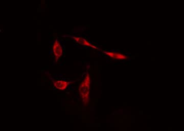 MB / Myoglobin Antibody