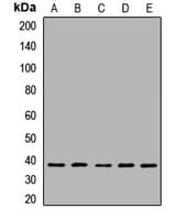 Polyclonal Rabbit anti-Human CAPZA1 / CAPZ Alpha 1 Antibody (WB)