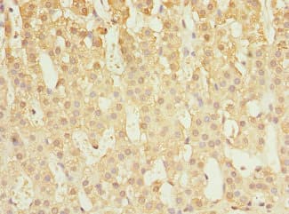 CAPNS1 / CAPN4 Antibody