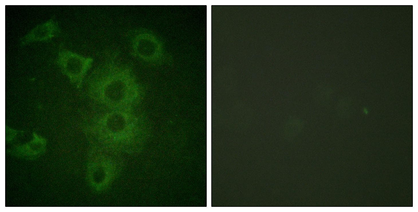 Polyclonal Rabbit anti-Human BIK Antibody (p33, IHC, IF, WB)