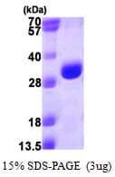 Human PSMA3 Protein (Recombinant His)