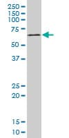 MAPKAPK2 / MAPKAP Kinase 2 Antibody (clone 3B8)