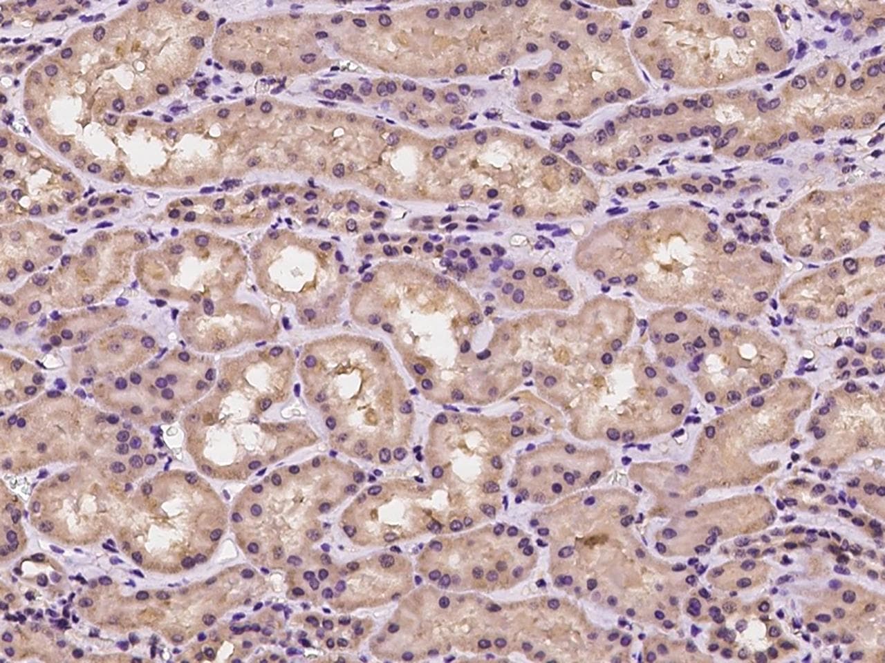 TRAIP / TRIP Antibody