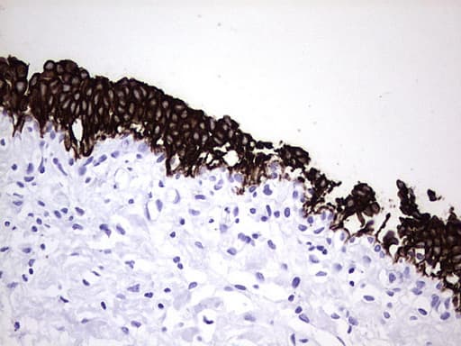 KRT7 / CK7 / Cytokeratin 7 Antibody (aa1-114, clone UMAB161, Carrier-free)