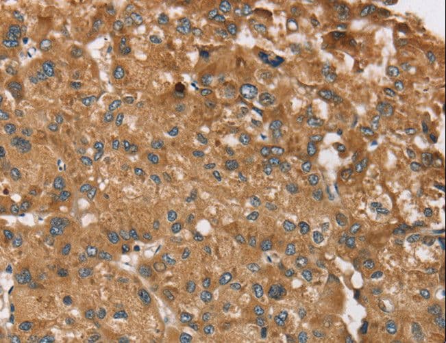 RPS6KA2 / RSK3 Antibody