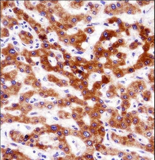 CCT4 / SRB Antibody (aa4-32)