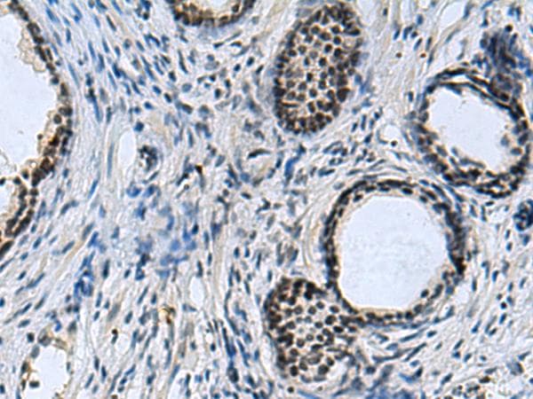 Polyclonal Rabbit anti-Human CCAR2 / KIAA1967 Antibody (IHC)