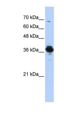 Polyclonal Rabbit anti-Human ATP6V0D2 Antibody (aa251-300, WB)