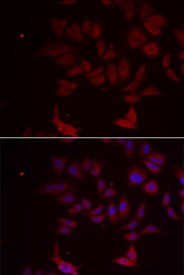 RPL11 / Ribosomal Protein L11 Antibody