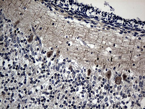 DNAJB6 Antibody (clone OTI5B5)