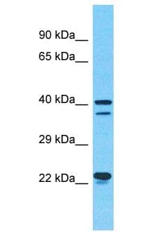 SEPHS1 / SPS Antibody (aa201-250)