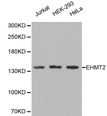 Polyclonal Rabbit anti-Human EHMT2 / G9A Antibody (IHC, WB)