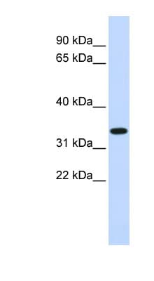 TRIM14 Antibody (aa204-231)