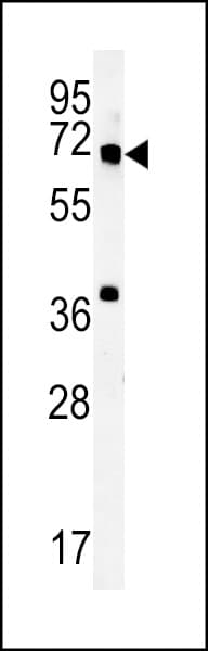 Polyclonal Rabbit anti-Human METTL16 / METT10D Antibody (aa444-472, WB)