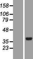 Human NT5C3A Protein (Over-Expression Lysate Myc-DDK (Flag))
