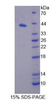 Mouse N-CoR / NCOR1 Protein (Recombinant His, N-Terminal)
