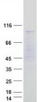 Human MED24 / TRAP100 Protein (Recombinant Myc-DDK (Flag))
