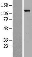 UBA1 / UBE1 Protein (Over-Expression Lysate Myc-DDK (Flag))