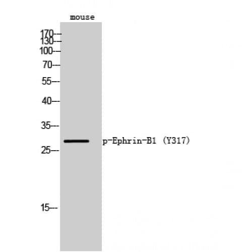 EFNB1 / Ephrin B1 Antibody (260-340 aa)