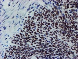 METTL16 / METT10D Antibody (clone OTI3B5)
