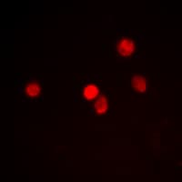 ZMYND8 / RACK7 Antibody (Internal)