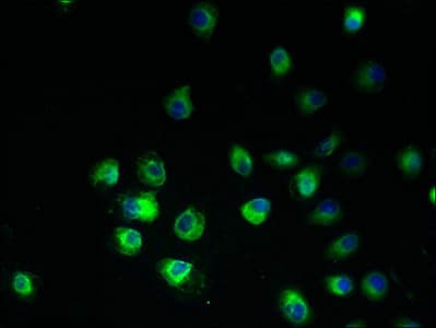 HARV1 / ARV1 Antibody (aa1-143)