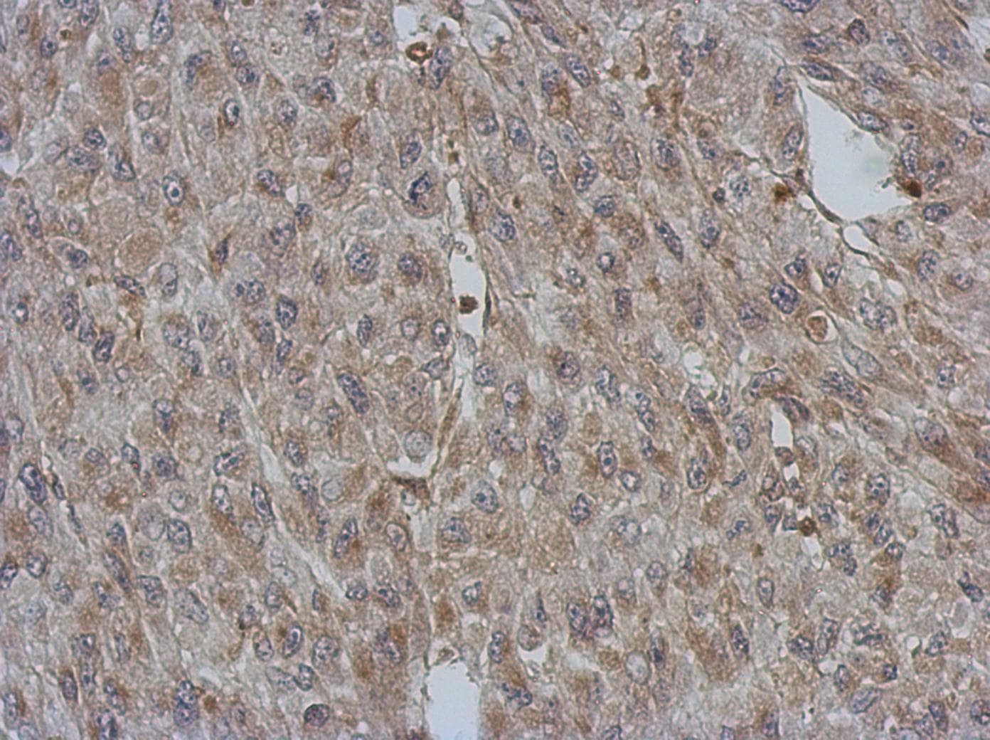 Polyclonal Rabbit anti-Human BNIP2 Antibody (IHC, WB)