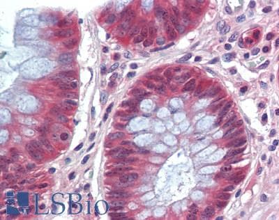 IHC-plus™ CISH / SOCS Antibody (aa1-257)