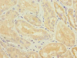 Polyclonal Rabbit anti-Human TNFSF15 / TL1A / VEGI Antibody (IHC)