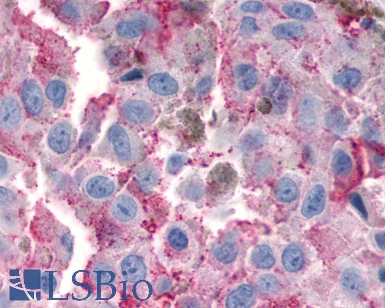 PathPlus™ Polyclonal Rabbit anti-Human VIPR1 Antibody (Cytoplasmic Domain, IHC)