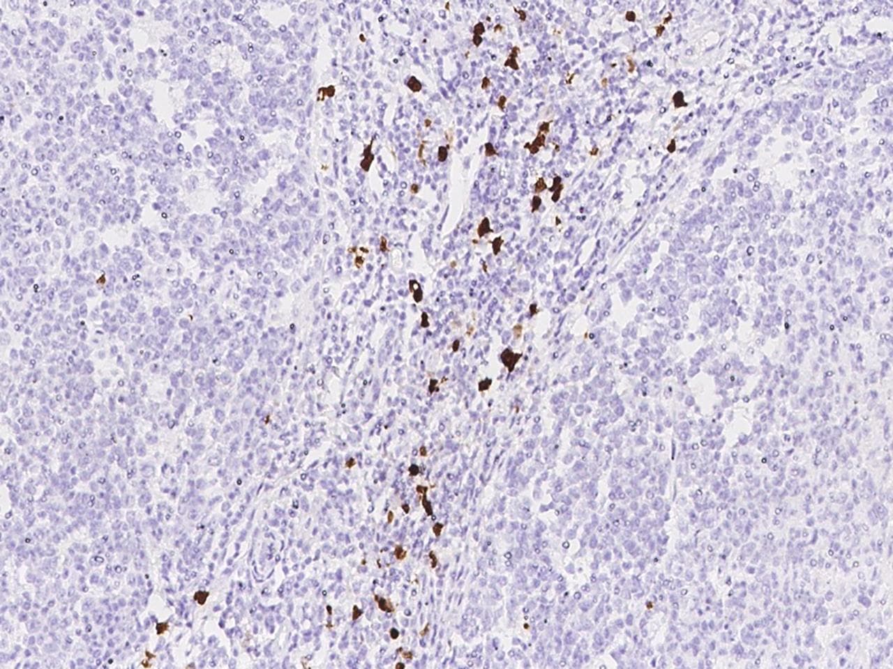 S100A8 / MRP8 Antibody (clone 216, Preservative Free)