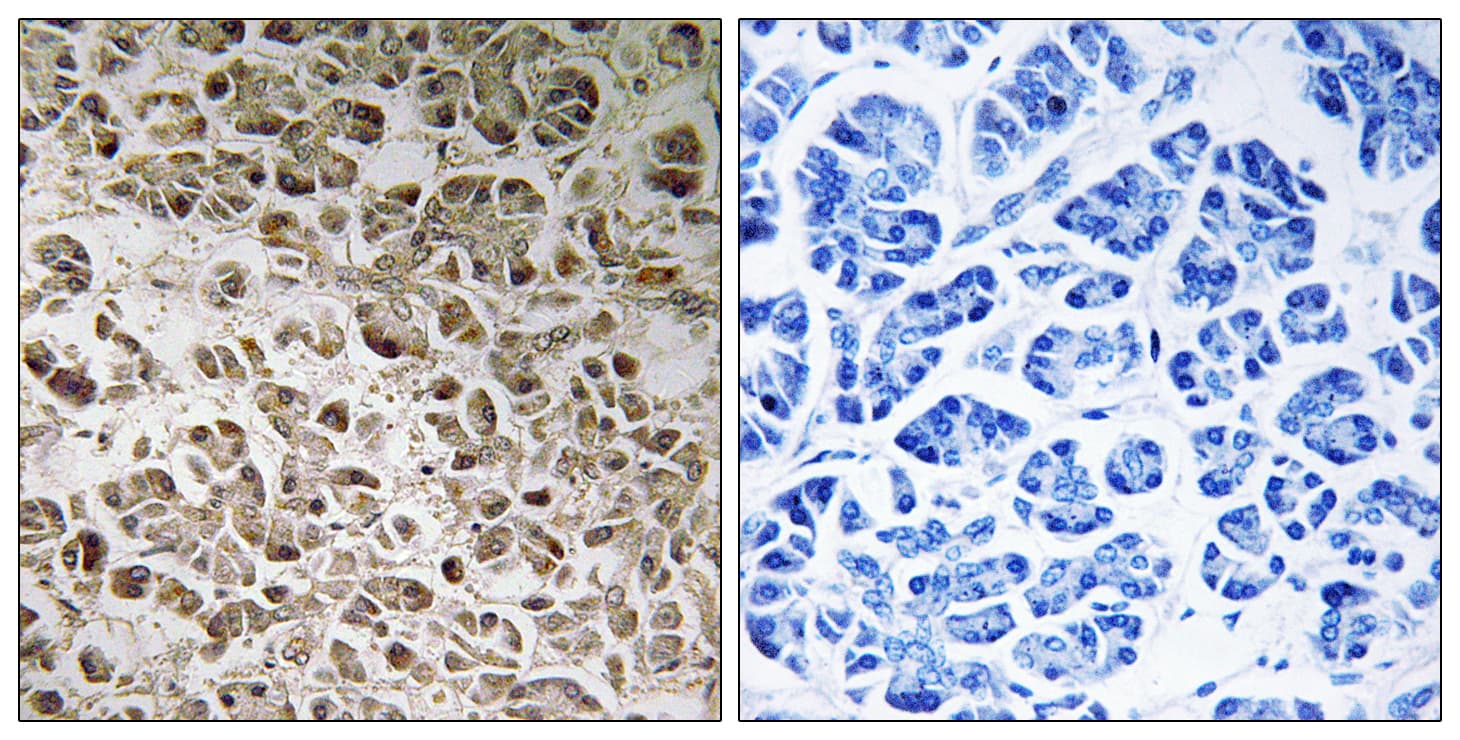 NDUFB1 / MNLL Antibody (aa7-56)
