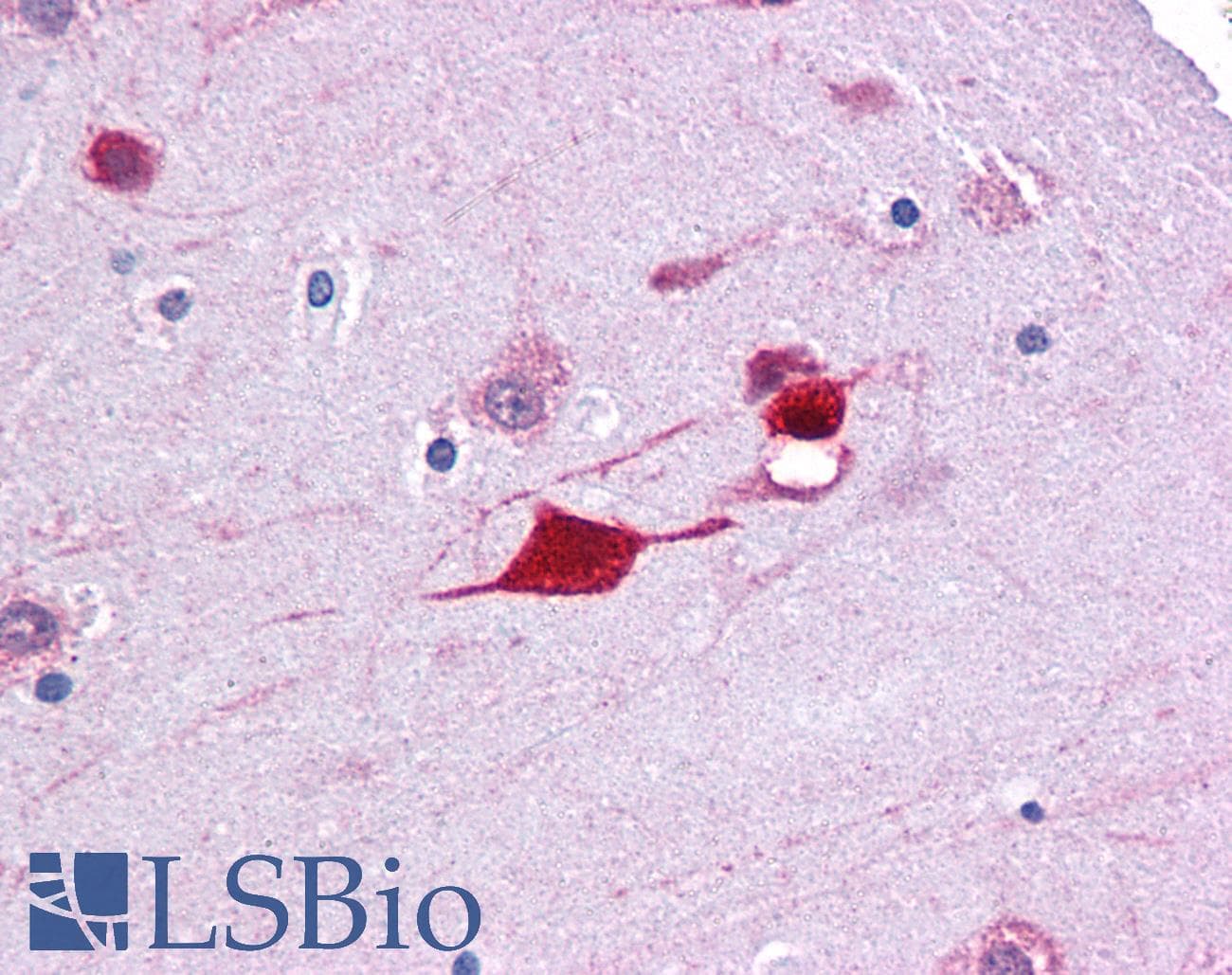 FABP4 / AP2 Antibody (aa71-120)
