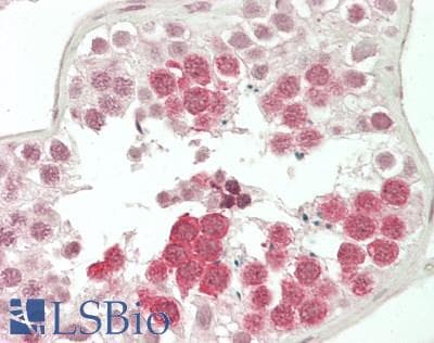 IHC-plus™ Polyclonal Rabbit anti-Human Securin / PTTG1 Antibody (IHC, WB)