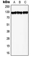 Polyclonal Rabbit anti-Human TERT / Telomerase Antibody (Internal, WB)