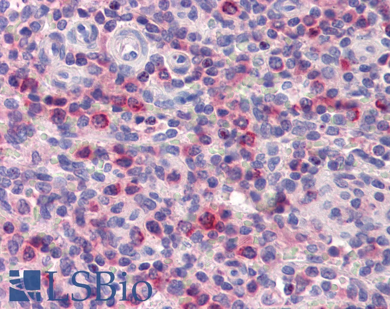 ONECUT1 / HNF6 Antibody (C-Terminus)