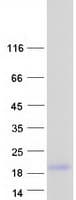 Human SPRR2D Protein (Recombinant Myc-DDK (Flag))