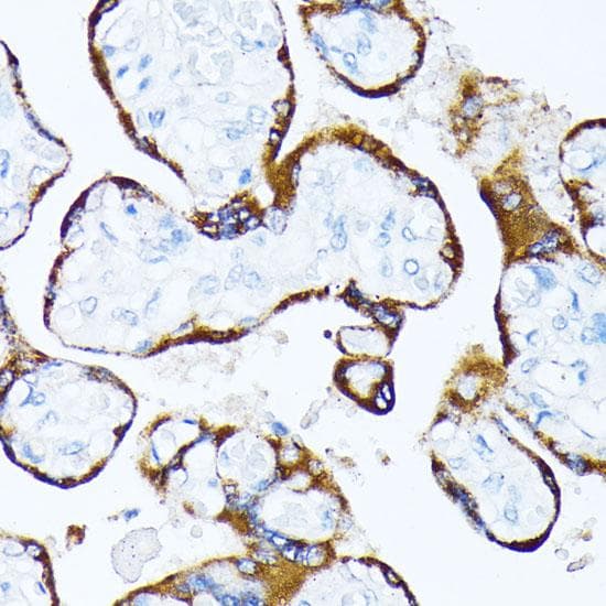 CSNK1A1 / CK1 Alpha Antibody