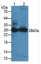 PRTN3 / Myeloblastin Antibody (aa24-249)