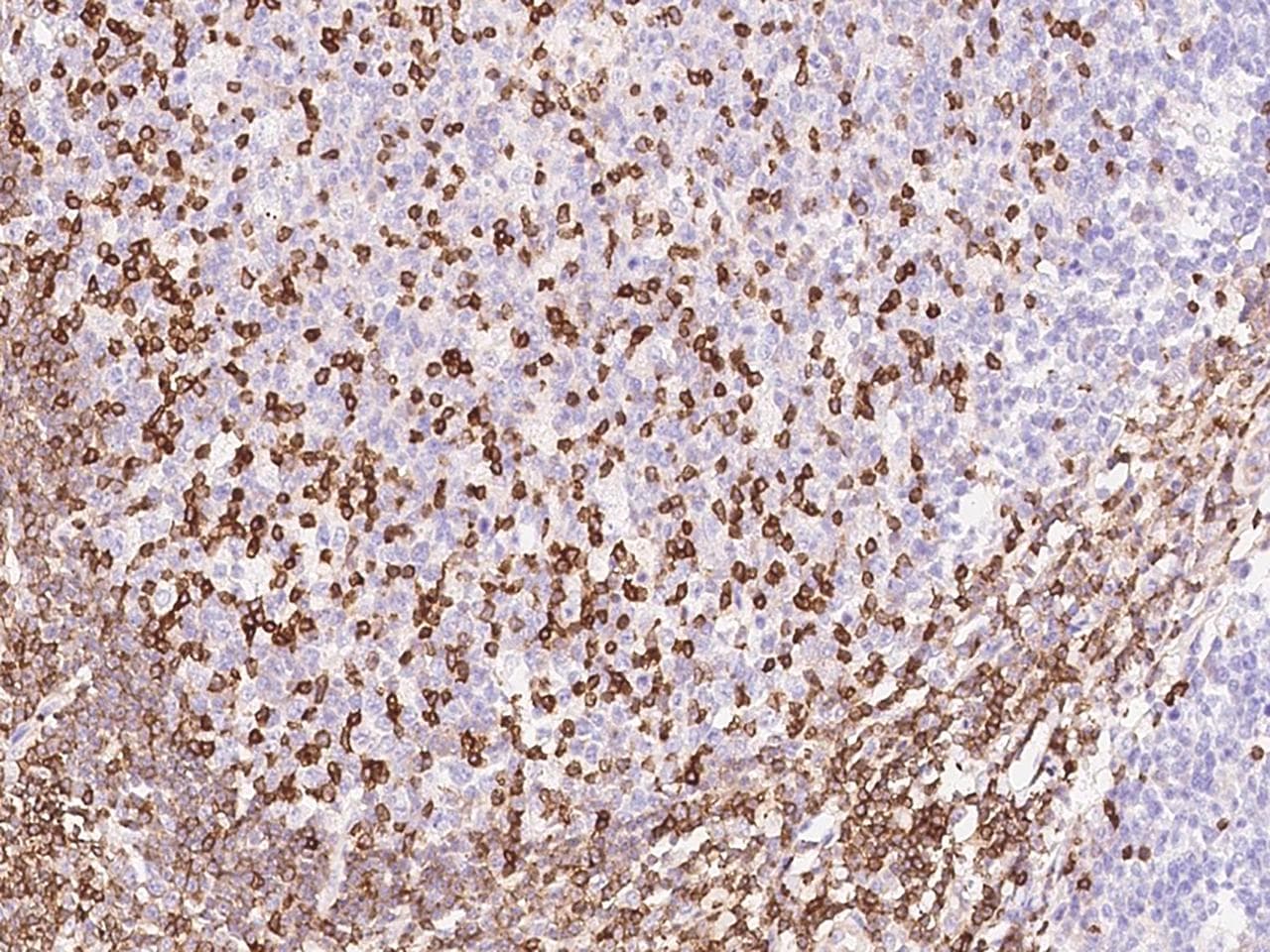 IL16 Antibody