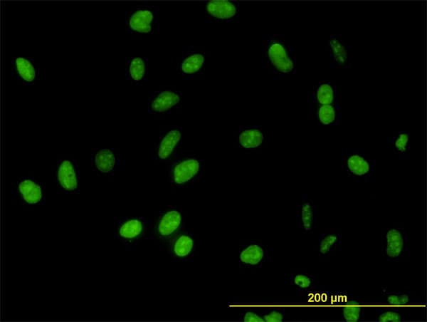 DP97 / DDX54 Antibody (clone 2H6)